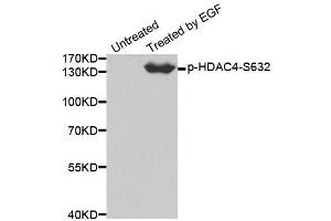 Western blot analysis of extracts from 293 cells using Phospho-HDAC4-S632 antibody (ABIN2988040). (HDAC4 anticorps  (pSer632))