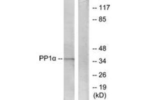 Western blot analysis of extracts from Jurkat cells, using PP1-alpha (Ab-320) Antibody. (PPP1CA anticorps  (AA 281-330))