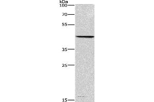 Western blot analysis of Hela cell, using BGN Polyclonal Antibody at dilution of 1:550 (Biglycan anticorps)