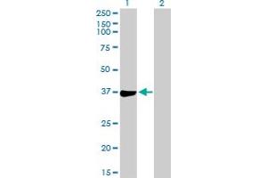 Western Blot analysis of PHF11 expression in transfected 293T cell line by PHF11 MaxPab polyclonal antibody. (PHF11 anticorps  (AA 1-292))
