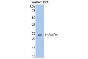 Western Blotting (WB) image for anti-Cadherin 2 (CDH2) (AA 384-562) antibody (ABIN1858323) (N-Cadherin anticorps  (AA 384-562))