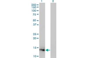 Western Blot analysis of IL2 expression in transfected 293T cell line by IL2 monoclonal antibody (M12), clone 1C1. (IL-2 anticorps  (AA 21-153))