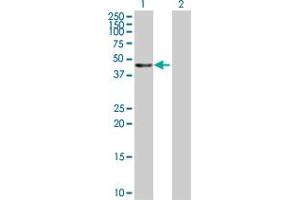 Western Blot analysis of KRT20 expression in transfected 293T cell line by KRT20 MaxPab polyclonal antibody. (KRT20 anticorps  (AA 1-424))