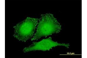 Immunofluorescence (IF) image for anti-Zyxin (ZYX) (AA 1-572) antibody (ABIN563471)