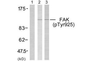 Western blot analysis of extracts using FAK (phospho- Tyr925) antibody (E011123). (FAK anticorps  (pTyr925))