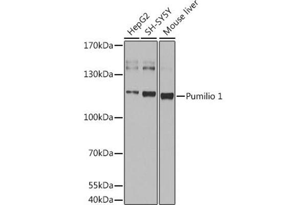 PUM1 anticorps  (AA 1-130)