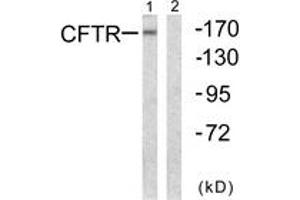 Western blot analysis of extracts from NIH-3T3 cells, using CFTR (Ab-737) Antibody. (CFTR anticorps  (AA 711-760))