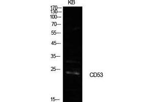 Western Blot (WB) analysis of KB cells using CD53 Polyclonal Antibody. (CD53 anticorps  (Internal Region))