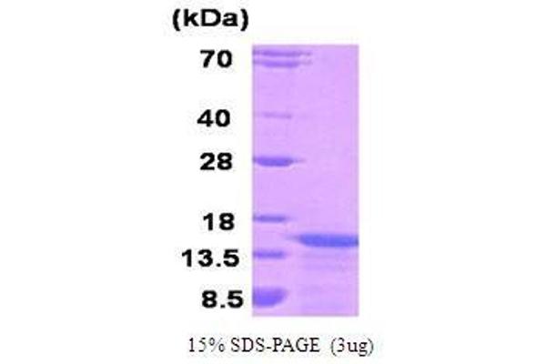 KISS1 Protein (AA 1-120)