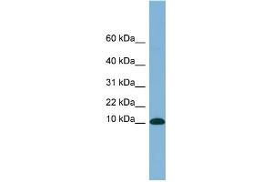 WB Suggested Anti-B2M Antibody Titration: 0. (beta-2 Microglobulin anticorps  (N-Term))