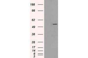 Western Blotting (WB) image for anti-Solute Carrier Family 2 (Facilitated Glucose/fructose Transporter), Member 5 (SLC2A5) antibody (ABIN1498476) (SLC2A5 anticorps)