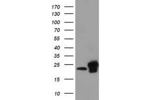 HEK293T cells were transfected with the pCMV6-ENTRY control (Left lane) or pCMV6-ENTRY SSSCA1 (Right lane) cDNA for 48 hrs and lysed. (SSSCA1 anticorps)