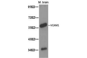 Western Blotting (WB) image for anti-Vascular Cell Adhesion Molecule 1 (VCAM1) antibody (ABIN1875313) (VCAM1 anticorps)