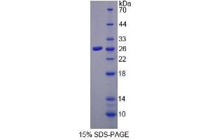 SDS-PAGE (SDS) image for Cholesteryl Ester Transfer Protein (CETP) ELISA Kit (ABIN6574210)