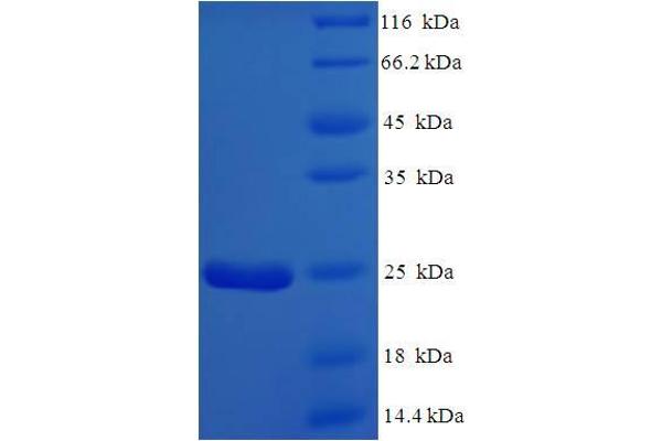 NMES1 Protein (AA 1-83, full length) (His-SUMO Tag)