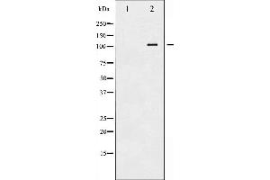 Western blot analysis of ATP1 alpha1/Na+K+ ATPase1 phosphorylation expression in Rat brain tissue lysates,The lane on the left is treated with the antigen-specific peptide. (ATP1A1 anticorps  (pSer23))