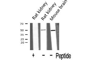 Western blot analysis of HDAC3 expression in various lysates (HDAC3 anticorps  (C-Term))