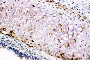 Anti-Collagen II antibody,  IHC(F) IHC(F): Rat Trachea Tissue (COL2A1 anticorps  (C-Term))