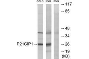 Western blot analysis of extracts from COLO/K562 cells, treated with EGF, using p21 Cip1 (Ab-145) Antibody. (p21 anticorps  (AA 111-160))