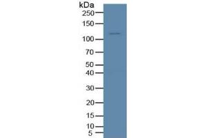 Western Blotting (WB) image for tyrosine Kinase with Immunoglobulin-Like and EGF-Like Domains 1 (TIE1) ELISA Kit (ABIN6730883)