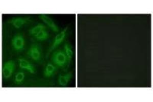Immunofluorescence analysis of HeLa cells, using CDH23 antibody. (CDH23 anticorps)