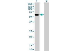 Western Blot analysis of G6PD expression in transfected 293T cell line by G6PD MaxPab polyclonal antibody. (Glucose-6-Phosphate Dehydrogenase anticorps  (AA 1-515))