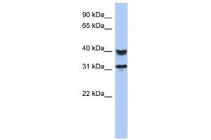 C5ORF35 antibody used at 1 ug/ml to detect target protein. (C5orf35 anticorps  (N-Term))