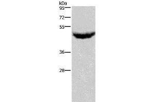 Western Blotting (WB) image for anti-Chemokine (C-X-C Motif) Receptor 2 (CXCR2) antibody (ABIN2431222) (CXCR2 anticorps)