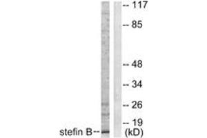 Western Blotting (WB) image for anti-Cystatin B (Stefin B) (CSTB) (AA 49-98) antibody (ABIN2889258) (CSTB anticorps  (AA 49-98))