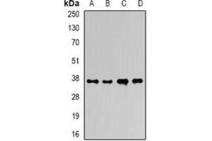 Western blot analysis of Ficolin 1 expression in HepG2 (A), mouse liver (B), mouse heart (C), rat liver (D) whole cell lysates. (FCN1 anticorps)