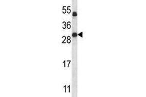 SIRT5 antibody western blot analysis in human placenta tissue lysate. (SIRT5 anticorps  (AA 99-127))