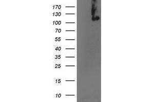 HEK293T cells were transfected with the pCMV6-ENTRY control (Left lane) or pCMV6-ENTRY ERCC4 (Right lane) cDNA for 48 hrs and lysed. (ERCC4 anticorps)