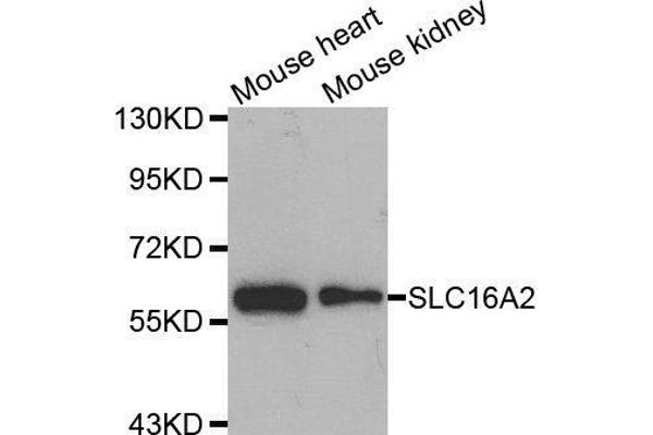 SLC16A2/MCT8 anticorps  (AA 1-100)