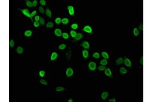 Immunofluorescence staining of Hela cells with ABIN7139604 at 1:2. (HIST1H4A anticorps  (meLys5))