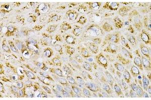 Immunohistochemistry of paraffin-embedded Human esophagus using EFNA1 Polyclonal Antibody at dilution of 1:100 (40x lens). (Ephrin A1 anticorps)