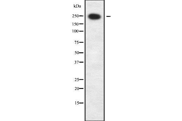 GARNL1 anticorps  (Internal Region)