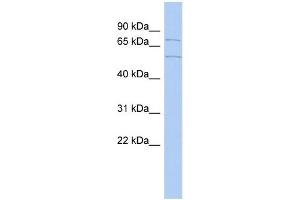 WB Suggested Anti-ZNF285A Antibody Titration:  0. (ZNF285 anticorps  (Middle Region))