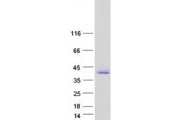 CEACAM19 Protein (Transcript Variant 2) (Myc-DYKDDDDK Tag)