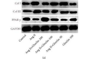 Western Blotting (WB) image for anti-Glyceraldehyde-3-Phosphate Dehydrogenase (GAPDH) (AA 1-335) antibody (ABIN3020538)