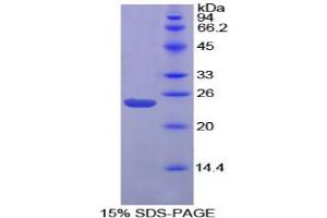 SDS-PAGE analysis of Chicken Gremlin 1 Protein. (GREM1 Protéine)