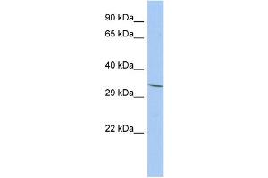 WB Suggested Anti-FAM78A Antibody Titration: 0. (FAM78A anticorps  (N-Term))