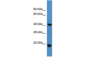 Host:  Rabbit  Target Name:  RGS7  Sample Type:  Jurkat Whole cell lysates  Antibody Dilution:  1. (RGS7 anticorps  (N-Term))