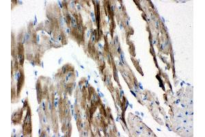 Anti-VDAC Picoband antibody, IHC(P) IHC(P): Mouse Cardiac Muscle Tissue (VDAC1 anticorps  (Middle Region))