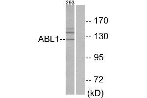 Immunohistochemistry analysis of paraffin-embedded human brain tissue using ABL1 antibody. (ABL1 anticorps  (Internal Region))