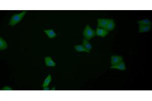 Detection of GAL3 in Human MCF7 cell using Polyclonal Antibody to Galectin 3 (GAL3) (Galectin 3 anticorps  (AA 1-250))