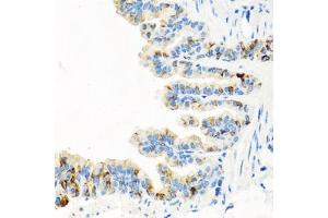 Immunohistochemistry of paraffin-embedded mouse lung using RGS5 antibody (ABIN5975077) at dilution of 1/100 (40x lens). (RGS5 anticorps)