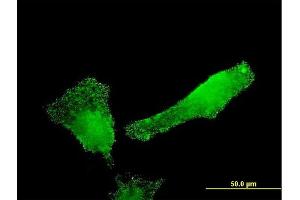 Immunofluorescence of monoclonal antibody to SH2D3C on HeLa cell. (SH2D3C anticorps  (AA 1-110))