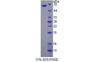 Image no. 1 for FYN Oncogene Related To SRC, FGR, YES (FYN) (AA 2-537) protein (His tag) (ABIN6237286) (FYN Protein (AA 2-537) (His tag))