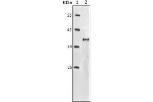 Western Blotting (WB) image for anti-Insulin-Like Growth Factor 1 Receptor (IGF1R) (truncated) antibody (ABIN2464067) (IGF1R anticorps  (truncated))
