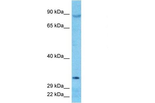 DNAJC16 anticorps  (N-Term)